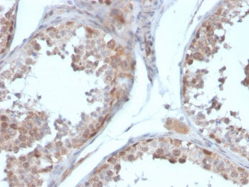 Follistatin Antibody / FST / Activin Binding Protein (FS288 &amp; FS315)