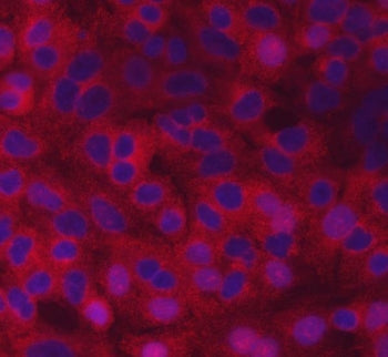 Immunofluorescent staining of FFPE human A549 cells with CVAK104 antibody (red) and DAPI nuclear stain (blue). HIER: steam section in pH6 citrate buffer for 20 min.