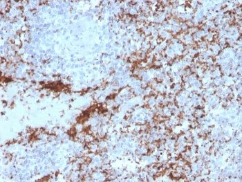 IHC testing of FFPE human spleen with recombinant ITGB3 antibody. Required HIER: boil tissue section
