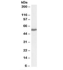 Western blot testing of cell line A431 lysate with PRPF31 antibody at 0.3ug/ml. Predicted molecular 