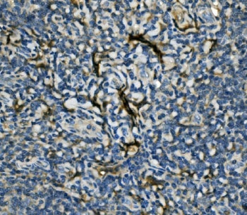 IHC staining of FFPE human tonsil with EIF4A1 antibody. HIER: boil tissue sections in pH8 EDTA for 2