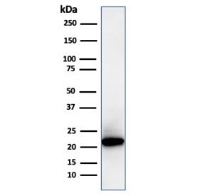 FTL Antibody / Ferritin Light Chain