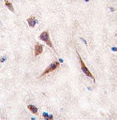 IHC testing of FFPE human brain tissue with ERAS antibody. HIER: steam section in pH6 citrate buffer