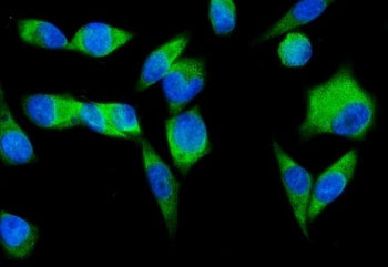 Immunofluorescent staining of FFPE human PC-3 cells with SND1 antibody (green) and DAPI nuclear stai