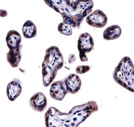 SOCS6 antibody immunohistochemistry analysis in formalin fixed and paraffin embedded human placenta 