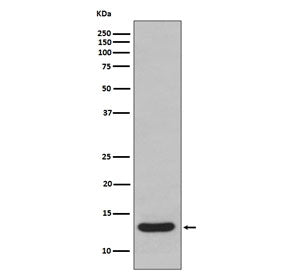 Western blot testing of human fetal liver lysate with FABP1 antibody. Predicted molecular weight ~14