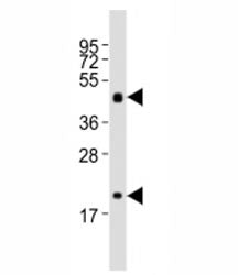 Shh Antibody / Sonic Hedgehog