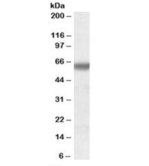 Western blot testing of human heart lysate with GPI antibody at 0.01ug/ml. Predicted molecular weigh