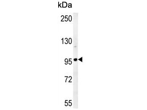 Western blot testing of human HeLa cell lysate with GIT1 antibody. Expected molecular weight: 84-95 