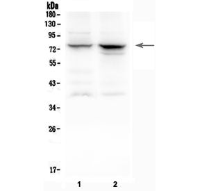 12 Lipoxygenase Antibody
