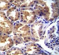 TRPM6 Antibody (CHAK2)