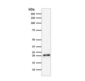 p21 Antibody / CDKN1A
