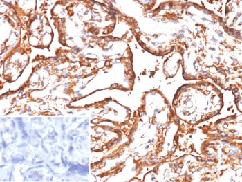 IHC staining of FFPE human placenta tissue with VEGFA antibody (clone VEGF/9368). Inset: PBS used in