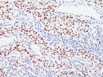 p57 Antibody / p57Kip2