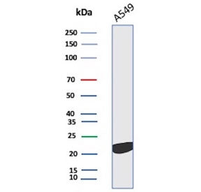 Western blot testing of human A549 cell lysate with Interleukin 18 antibody. Predicted molecular wei
