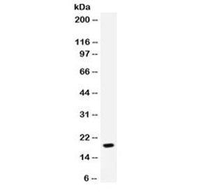 Western blot testing of human MCF7 cell lysate with NAP-2 antibody. Predicted molecular weight: 8~14
