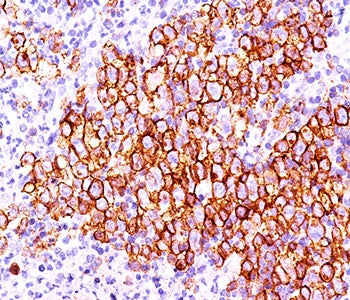 CD30 Antibody