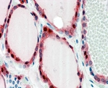 IHC testing of FFPE human thyroid gland with Frizzled 2 antibody at 2.5ug/ml. HIER: steamed with pH6