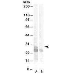 Western blot testing of muscle lysate with MYF5 antibody at 0.5ug/ml with [B] and without [A] blocki