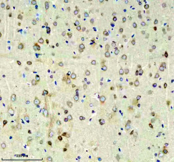 Immunohistochemical staining of RIM1/RIMS1 using anti-RIMS1 antibody. RIM1/RIMS1 was detected in a p