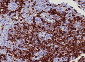IHC staining of FFPE human lymph node tissue with CD45RA antibody (clone PTPRC/8341R). HIER: boil ti
