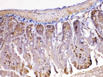 IHC testing of FFPE mouse intestine tissue with Ada antibody at 1ug/ml. Required HIER: steam section