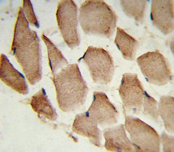 IHC testing of FFPE human skeletal muscle tissue with ARPC1A antibody. HIER: steam section in pH6 ci