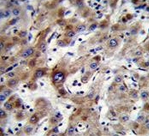 IHC testing of FFPE human liver tissue with ADP,ATP carrier protein 3 antibody. HIER: steam section 