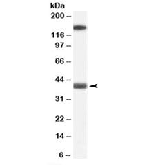 Western blot testing of human heart lysate with GALR1 antibody at 0.1ug/ml. The expected ~40kDa band