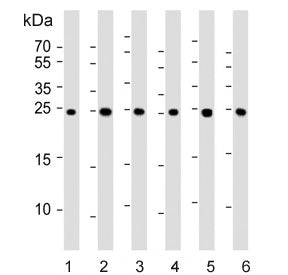 Western blot testing of human 1) liver, 2) HeLa, 3) HepG2, 4) MCF7, 5) mouse Neuro-2a and 6) rat PC-