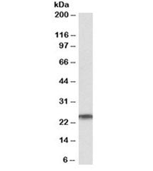 Western blot testing of human testis lysate with RAN antibody at 1ug/ml. Predicted molecular weight 