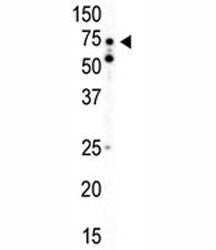 AMPK alpha 2 Antibody (PRKAA2)