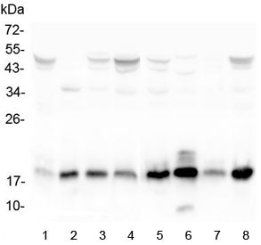 Western blot testing of human 1) placenta, 2) K562, 3) T-47D, 4) Caco-2, 5) HeLa, 6) ThP-1, 7) A431 