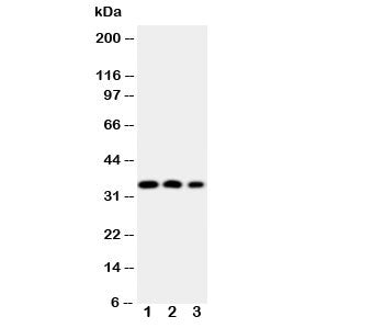 Western blot testing of HOXA4 antibody and Lane 1: SW620; 2: SW620; 3: PC-12 cell nuclear lysate. Pr
