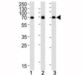 p70 S6 Kinase beta Antibody (RPS6KB2), 0.08ml