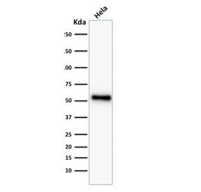 Western blot testing of human HeLa cell lysate with recombinant p53 antibody (clone TP53/2092R).