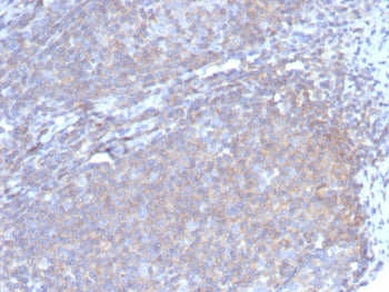 IHC staining of FFPE human lymph node tissue with G-CSF antibody (clone CSF3/4597). HIER: boil tissu