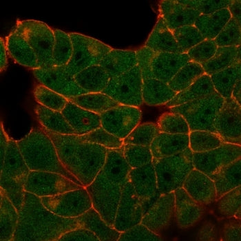 Immunofluorescent staining of PFA-fixed MCF7 cells using E4F1 antibody (green, clone PCRP-E4F1-2D1) 