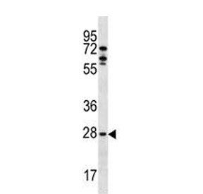 Western blot testing of human MCF7 lysate with MLF1 antibody. Predicted molecular weight ~31 kDa.