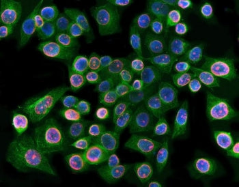 Lamin B1 Antibody