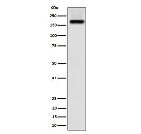 Western blot testing of human A673 cell lysate with ZFYVE9 antibody. Predicted molecular weight ~156
