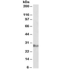 Western blot testing of human adipose lysate with IL22 antibody at 0.3ug/ml. Observed molecular weig