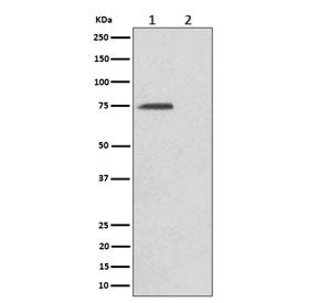 Western blot testing of lysate from human HeLa cells, untreated (1) or treated with Alkaline phospha