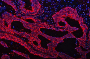 TRMT61B Antibody