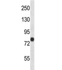 FACL4 antibody western blot analysis in human 293 lysate. Predicted molecular weight ~80 kDa (long f
