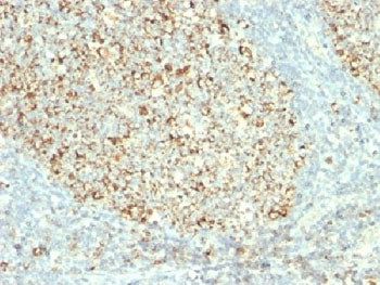 Mitochondrial Marker Antibody