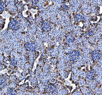 IHC staining of FFPE mouse kidney tissue with Annexin V antibody, HRP-labeled secondary and DAB subs