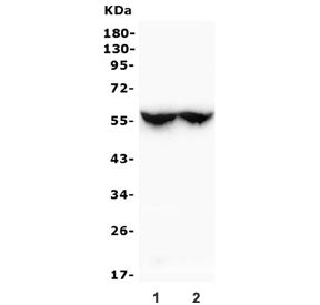 Western blot testing of different lots of rat liver lysate with CYP2C19 antibody. Predicted molecula