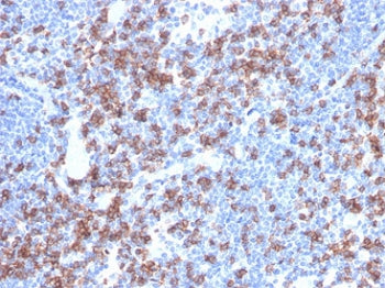 IHC staining of FFPE human lymph node with recombinant CD8A antibody (clone rCD8/6590). HIER: boil t