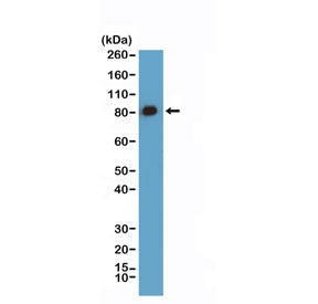 Western blot testing of human HeLa cell lysate with recombinant Caldesmon antibody at 1:100 dilution
